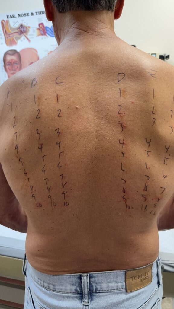 Man with six rows of 10 numbers handwritten vertically on his back